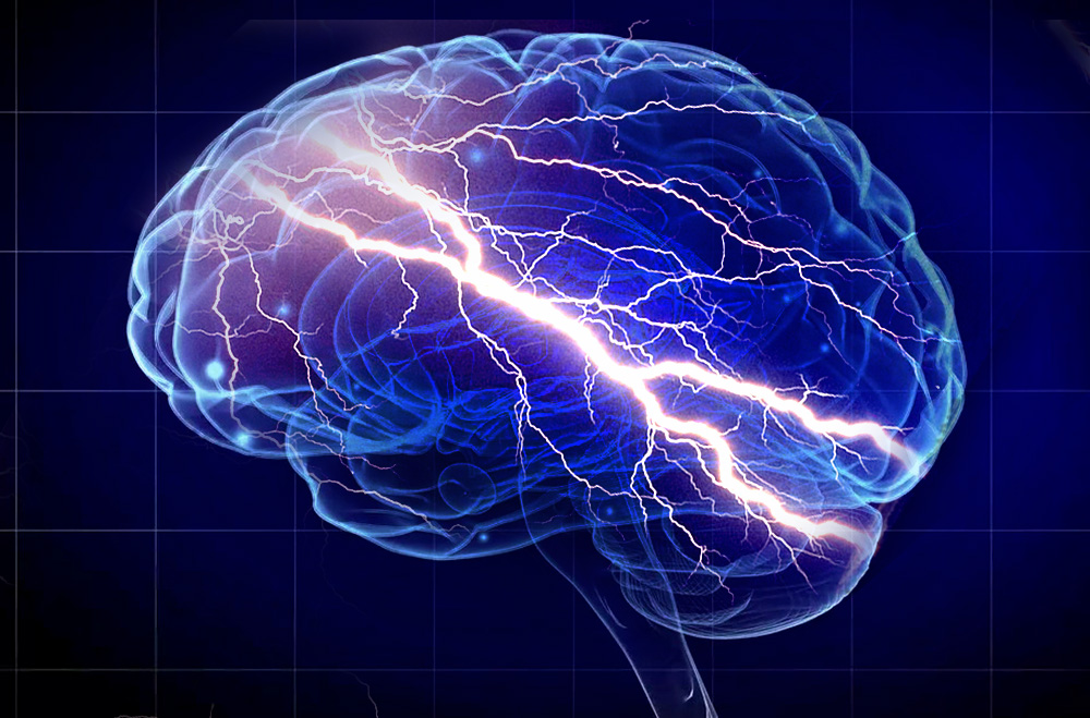 Brain-zaps sur ordonnance